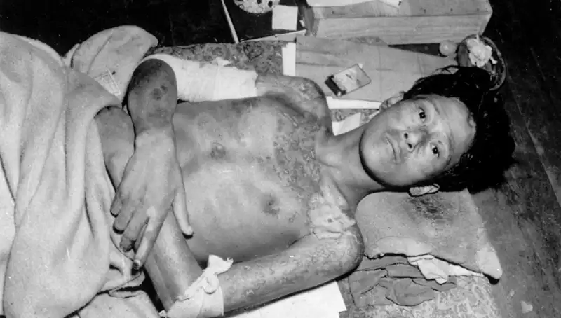 80 Yıl Sonra Nagasaki’den Geldi: Nükleer Felaket Uyarısı ve Gelecek Tehlikeleri
