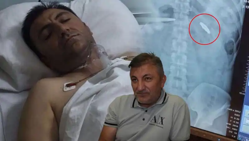 15 Temmuz'un Hatırası: Vücudundaki Kurşunlarla Yaşamak