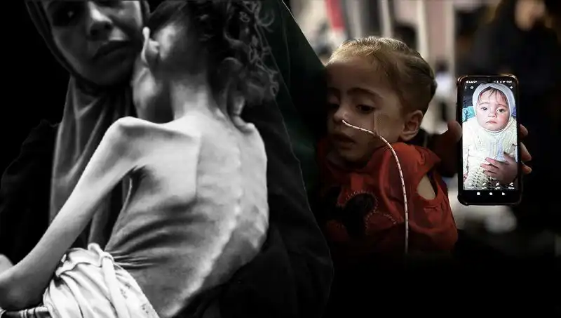 Küçük Meryem'in Acı Hikayesi: 25 Kilodan 10 Kiloya Düşüşü